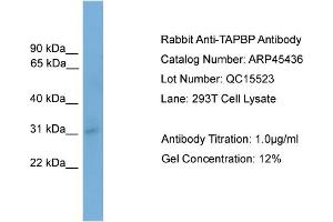 WB Suggested Anti-TAPBP  Antibody Titration: 0. (TAPBP antibody  (N-Term))