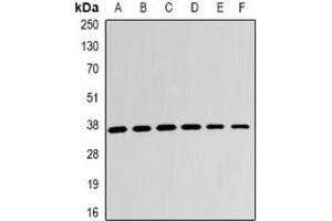 Western blot analysis of LDHB expression in A431 (A), Jurkat (B), A549 (C), mouse kidney (D), mouse lung (E), rat brain (F) whole cell lysates. (LDHB antibody)