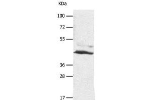 Western Blot analysis of A549 cell using SLC16A7 Polyclonal Antibody at dilution of 1:450