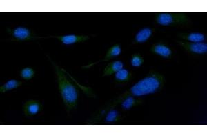 IF analysis of PLCG 2/PLCG2 using anti-PLCG 2/PLCG2 antibody (ABIN5692854).