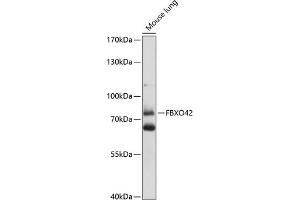 Western blot analysis of extracts of mouse lung, using FBXO42 antibody (ABIN7267092) at 1:1000 dilution. (FBXO42 antibody  (AA 468-717))