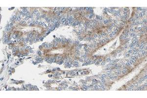 ABIN6268879 at 1/100 staining Human prostate tissue by IHC-P.