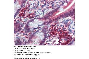 Immunohistochemistry with Human Small Intestine tissue at an antibody concentration of 5. (TRIM35 antibody  (Middle Region))