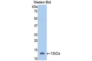 WB of Protein Standard: different control antibodies against Highly purified E. (Vitamin D-Binding Protein ELISA Kit)