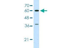 Western blot analysis of Jurkat cell lysate with HNRNPL polyclonal antibody . (HNRNPL antibody  (AA 82-131))