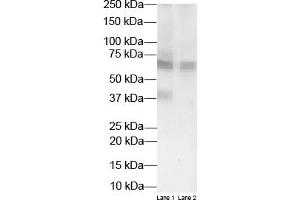 WB Suggested Anti-HSD11B1 Antibody Titration:  2 ug/ml  Positive Control:  Transient overexpression lysate of HSD11B1 and Non-overexpressed vector control lysate