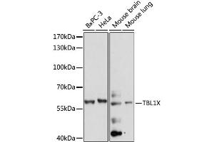 Western blot analysis of extracts of various cell lines, using TBL1X antibody. (TBL1X antibody)