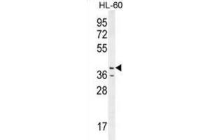 Western Blotting (WB) image for anti-Caspase 12 (Gene/pseudogene) (CASP12) antibody (ABIN2996496) (Caspase 12 antibody)