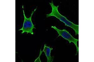 Immunofluorescence analysis of LOVO cells using Rab10 mouse mAb (green). (RAB10 antibody)