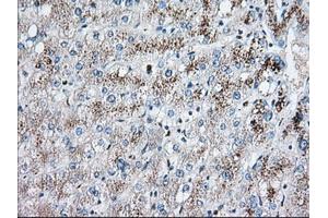 Immunohistochemical staining of paraffin-embedded Human liver tissue using anti-EIF2S1 mouse monoclonal antibody. (EIF2S1 antibody)