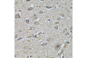 Immunohistochemistry of paraffin-embedded human brain cancer using WIPI1 Antibody (ABIN2560779) at dilution of 1:100 (40x lens). (WIPI1 antibody)