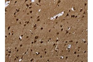 The image on the left is immunohistochemistry of paraffin-embedded Human brain tissue using ABIN7189815(ANP32E Antibody) at dilution 1/20, on the right is treated with synthetic peptide. (ANP32E antibody)
