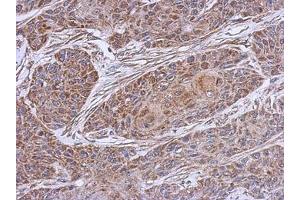 Image no. 2 for anti-NADH Dehydrogenase (Ubiquinone) 1 beta Subcomplex, 4, 15kDa (NDUFB4) (AA 1-129) antibody (ABIN1501991)