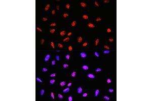 Immunofluorescence analysis of U-2 OS cells using P Rabbit mAb (ABIN7269445) at dilution of 1:100 (40x lens). (PABPN1 antibody)