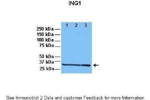 Lanes:   1: 30ug HeLa lysate, 2: 30ug HFF lysate, 3: 30ug U2OS lysate  Primary Antibody Dilution:   1:1000  Secondary Antibody:   Anti-rabbit HRP  Secondary Antibody Dilution:   1:5000  Gene Name:   ING1  Submitted by:   Dr. (ING1 antibody  (C-Term))