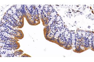 Immunohistochemistry (IHC) image for anti-Keratin 5 (KRT5) (AA 335-473) antibody (ABIN7437212)