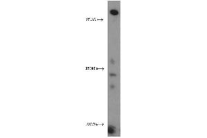 Western Blotting (WB) image for anti-Xin Actin-Binding Repeat Containing 2 (XIRP2) antibody (ABIN2906145) (XIRP2 antibody)