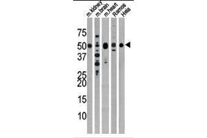 The anti-Drosophila Parkin Pab is used in Western blot to detect Drosophila Parkin in, from left to right, mouse kidney, mouse brain, mouse heart, Ramos, and Hela tissue lysates. (Parkin antibody  (N-Term))
