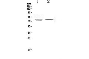 Western blot analysis of STAM1 using anti-STAM1 antibody .