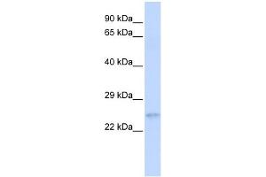 RHOC antibody used at 1 ug/ml to detect target protein.
