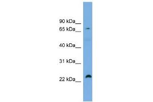 WB Suggested Anti-SPG20 Antibody Titration: 0.