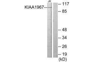 Western blot analysis of extracts from Jurkat cells, using KIAA1967 antibody. (CCAR2 antibody)