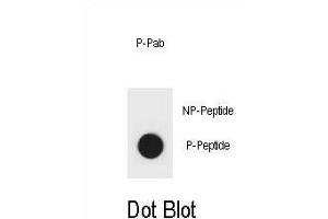 Dot blot analysis of mouse IKKB Antibody (Phospho ) Phospho-specific Pab (ABIN1881452 and ABIN2839957) on nitrocellulose membrane.