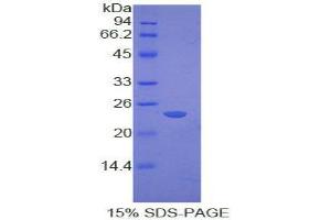 SDS-PAGE (SDS) image for Cathepsin G (CTSG) (AA 51-250) protein (His tag) (ABIN2120779)