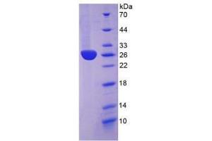 SDS-PAGE analysis of Rabbit C-Reactive Protein.