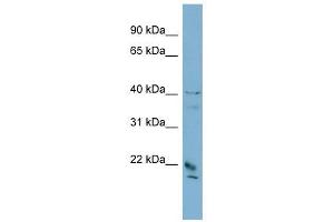 DYDC1 antibody used at 1 ug/ml to detect target protein. (DYDC1 antibody  (Middle Region))