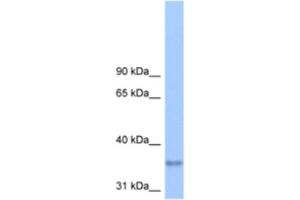 Western Blotting (WB) image for anti-Lipid Phosphate Phosphatase-Related Protein Type 2 (LPPR2) antibody (ABIN2463290) (LPPR2 antibody)