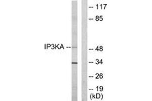 Western Blotting (WB) image for anti-Inositol-Trisphosphate 3-Kinase A (ITPKA) (AA 396-445) antibody (ABIN2889428) (ITPKA antibody  (AA 396-445))