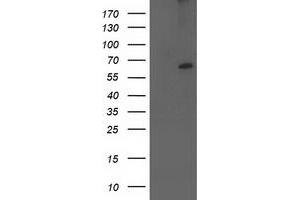 HEK293T cells were transfected with the pCMV6-ENTRY control (Left lane) or pCMV6-ENTRY CYP2J2 (Right lane) cDNA for 48 hrs and lysed. (CYP2J2 antibody)