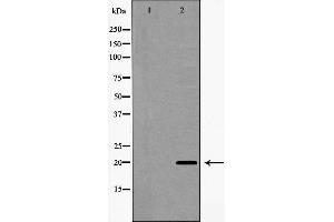 Western blot analysis of Interleukin 20 expression in A549 cells,The lane on the left is treated with the antigen-specific peptide. (IL-20 antibody  (Internal Region))