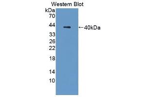 Western blot analysis of the recombinant protein. (Cathepsin L antibody  (AA 18-113))