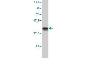 Western Blotting (WB) image for anti-MAP/microtubule Affinity-Regulating Kinase 2 (MARK2) (AA 401-500) antibody (ABIN560734)