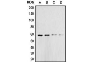 Western blot analysis of Caspase 10 expression in HeLa (A), Jurkat (B), A431 (C), K562 (D) whole cell lysates.