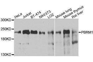 Western blot analysis of extracts of various cell lines, using PBRM1 antibody (ABIN6003610) at 1/1000 dilution. (Polybromo 1 antibody)