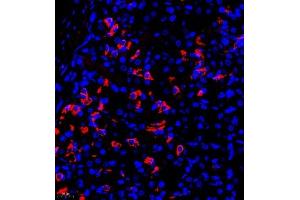 Immunofluorescence of paraffin embedded rat stomach using TR2IT1 (ABIN7075887) at dilution of 1:650 (400x lens) (TXNRD3NB antibody)