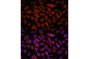 Immunofluorescence analysis of L929 cells using STK38L antibody (ABIN7270226) at dilution of 1:100. (STK38L antibody  (AA 165-464))