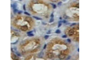 Used in DAB staining on fromalin fixed paraffin-embedded Kidney tissue (GLB1 antibody  (AA 68-219))