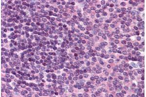 Human Spleen: Formalin-Fixed, Paraffin-Embedded (FFPE) (GNPDA2 antibody  (C-Term))