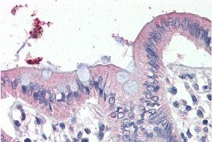 Immunohistochemistry (IHC) image for anti-Sodium Channel, Nonvoltage-Gated 1, gamma (SCNN1G) (C-Term) antibody (ABIN308448)