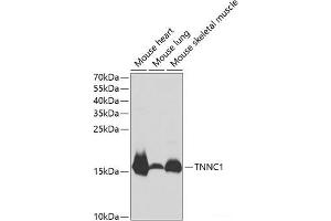 Western blot analysis of extracts of various cell lines using TNNC1 Polyclonal Antibody at dilution of 1:1000. (TNNC1 antibody)