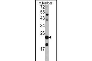 Western blot analysis of TAGLN antibody in mouse bladder tissue lysates (35ug/lane)