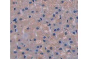 Used in DAB staining on fromalin fixed paraffin- embedded Kidney tissue (GLI1 antibody  (AA 810-1109))