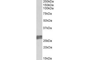 ABIN1590057 (0. (TNNI3 antibody  (AA 117-127))
