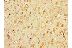 Immunohistochemistry of paraffin-embedded human placenta tissue using ABIN7176684 at dilution of 1:100 (SLC3A7 (AA 162-236) antibody)