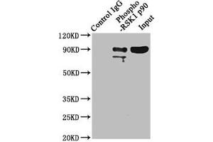 Immunoprecipitating Phospho-RPS6KA1 in Hela whole cell lysate Lane 1: Rabbit control IgG(1 μg)instead of ABIN7127744 in Hela whole cell lysate. (Recombinant RPS6KA1 antibody  (pSer363, pThr359))