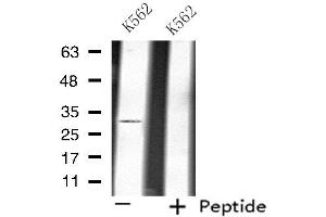 Western blot analysis of extracts from K562 cells, using ATP1B3 antibody. (ATP1B3 antibody  (Internal Region))